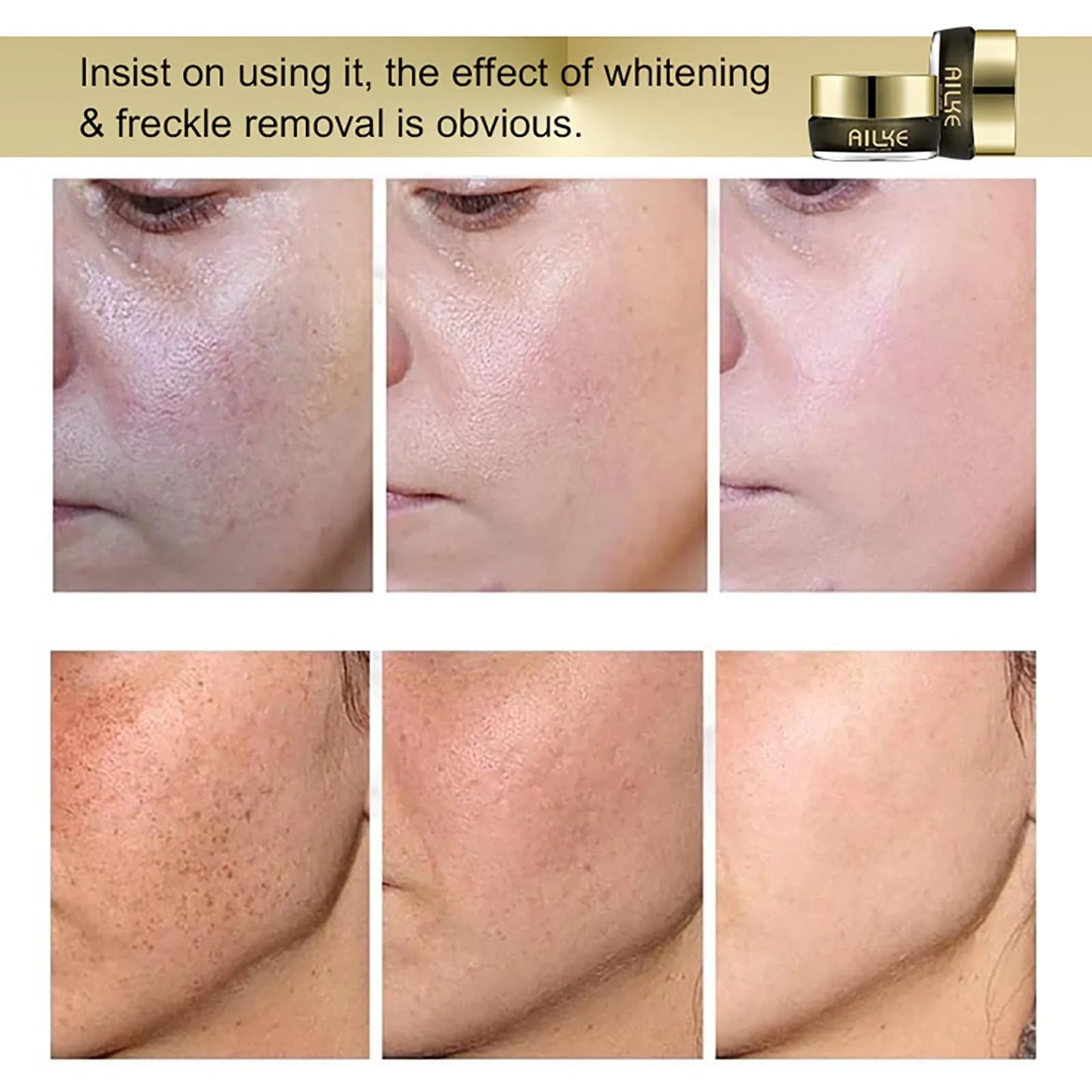 AILKE Whitening And Removing Freckle Cream, Brightening Hydrating ,Suitable For Black And Dark Skin, Korean Bleaching Skin Care